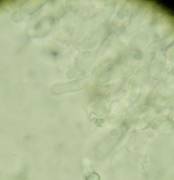 Crosta giallina da determinare (Hyphoderma radula)